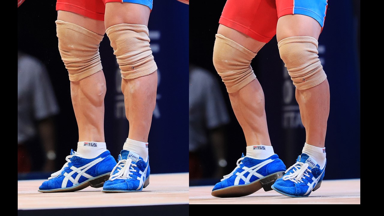 Muscles of the Shank, Movement of the Shin & Susceptibility to Lower