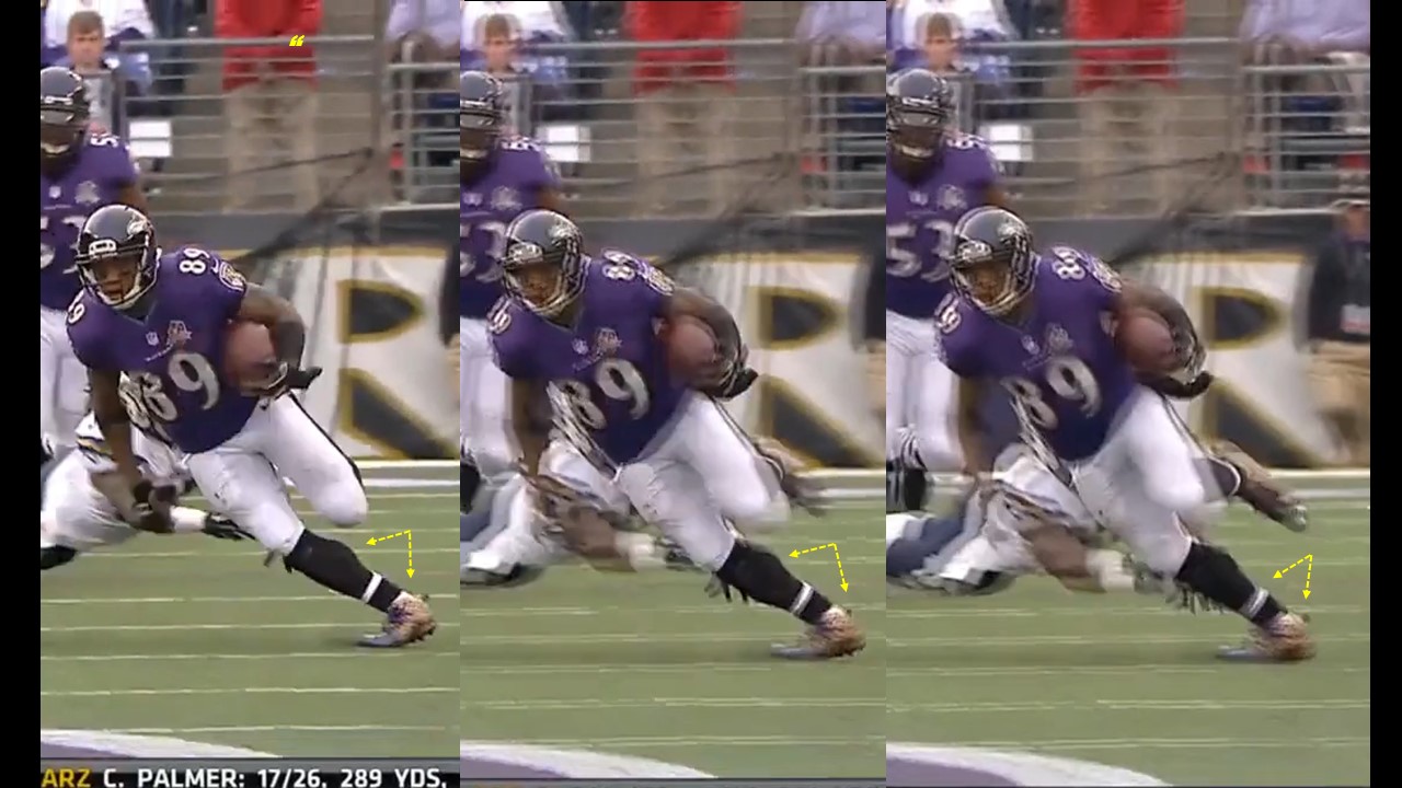 Achilles Tendon Ruptures and the NFL Sportivny Press